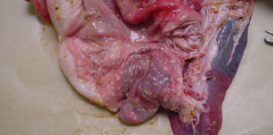 Reacción exagerada en la zona glandular del cardias sin ulceración