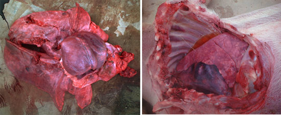 Pleuropneumonia fibrosa con exhudado