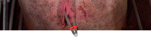 Cerrando los catéteres con gomas