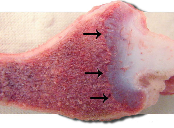 Flared costochondral junction, rachitic rosary, with irregular and elongated growth cartilage (arrows). 