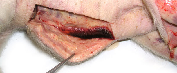 Hinchazón del tejido subcutáneo, emerge una gran cantidad de fluido tras una incisión de la piel en la zona baja del cuerpo