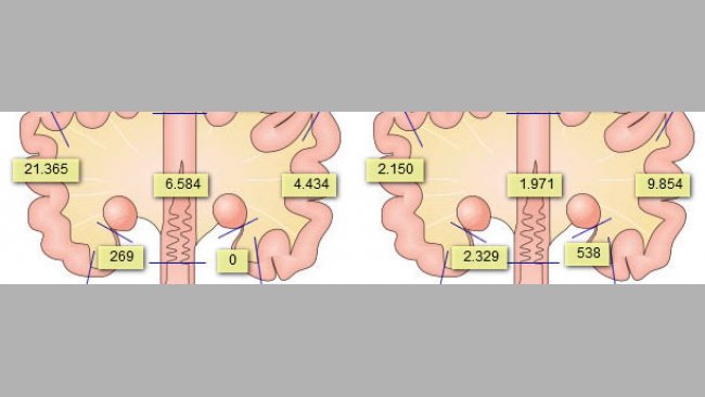 Presencia de espermatozoides en el aparato genital de la cerda, tras haber realizado 2 inseminaciones 