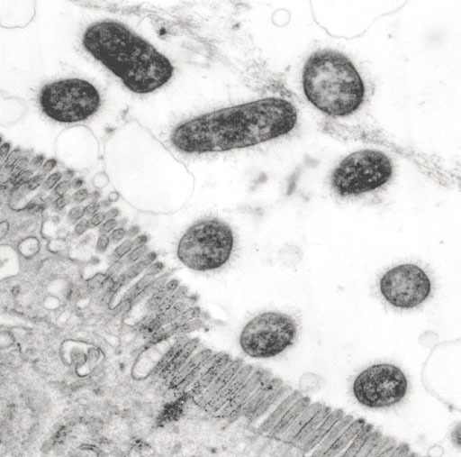 Bacteria ETEC produciendo adhesinas fimbriales similares a pelos en su superfície y adheriendose a células epiteliales intestinales en un cerdo con diarrea, como se observa mediante microscopía de electrones