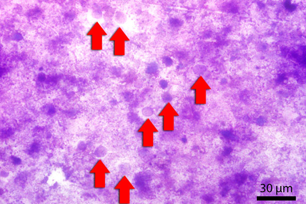 Fecal smear stained with Diff-Quick. Red arrows indicate Blastocystis-stages