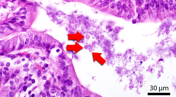 Histological section of the colon. Red arrows indicate Blastocystis-stages in the gut lumen