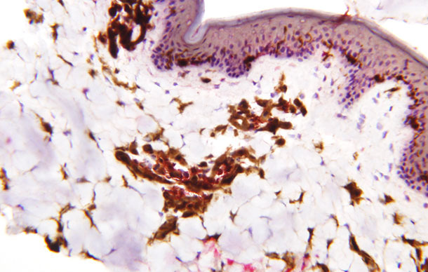 Distribución de las células dendríticas en la epidermis, dermis y tejido subcutáneos en el cerdo.