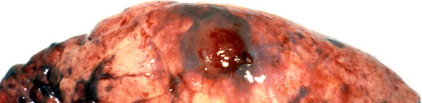 Lesión típica de Acpp – la lesión pulmonar hemorrágica y necrótica está cubierta por una adherencia pleural.