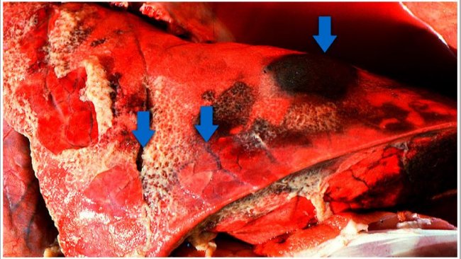 Los tres hallazgos t&iacute;picos de la pleuropneumonia porcina aguda: 1) &aacute;reas consolidadas de color rojo oscuro a negro; 2) edema interlobular y 3) pleuritis fibrinosa. Cortes&iacute;a del Dr Robert Desrosiers
