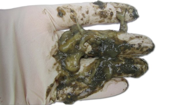 Diarrea catarral