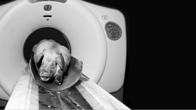 Tomografía computerizada