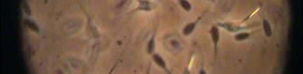 El examen del semen al microscopio