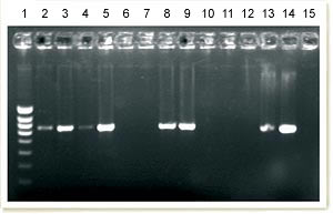 PCR para la detección de DNA de PCV2