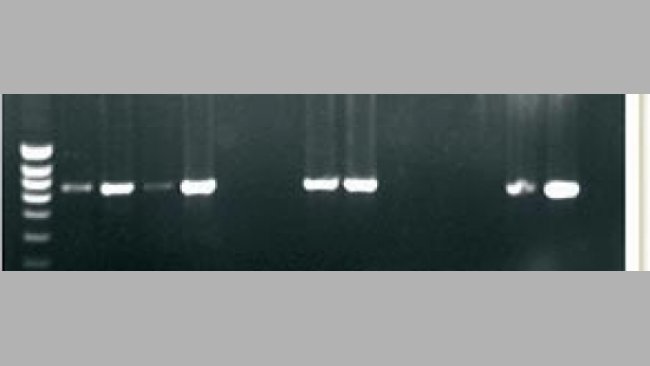 PCR para la detección de DNA de PCV2