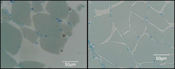 En la figura de la izquierda, jamón curado no presurizado. A la derecha, el mismo jamón presurizado a 600 MPa. Imágenes obtenidas por microscopia óptica.