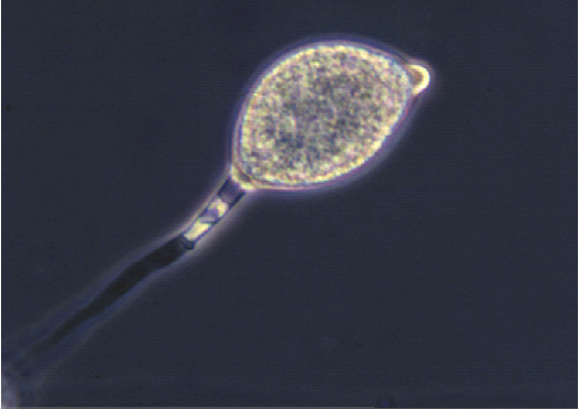 Phytophthora infestans