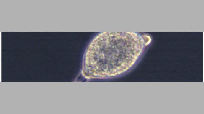 Phytophthora infestans