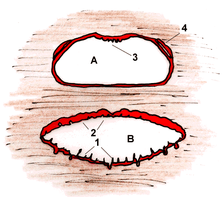 Representación esquemática del anillo de tejido linfático de la faringe al realizar un corte transversal A-A´ a nivel de la faringe del cerdo.