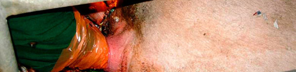 Extracción de lechones