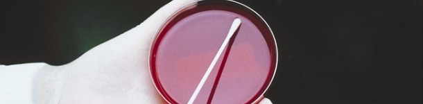 Analisis microbiologico