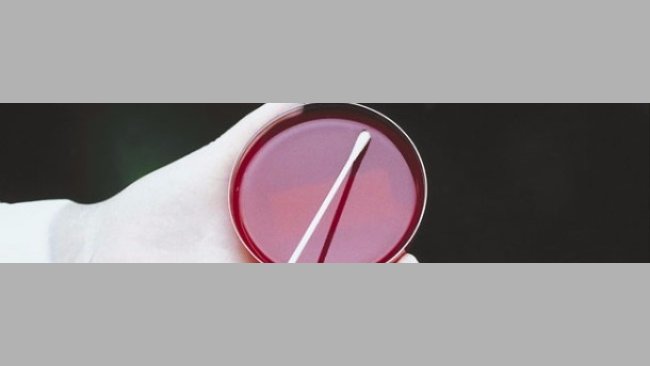 Analisis microbiologico