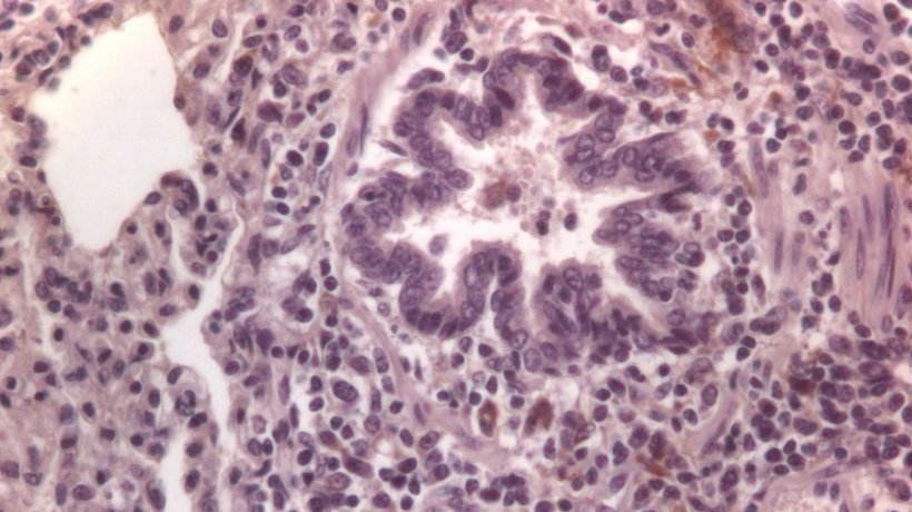 Figura 3: C&eacute;lulas inmunomarcadas frente a PCV2 en pulm&oacute;n.
