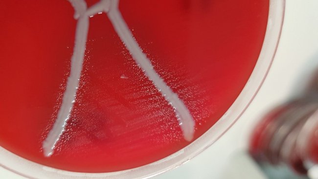 Glaesserella australis en placa de sangre con Staphylococcus aureus mostrando satelitismo. Fuente: QAAFI