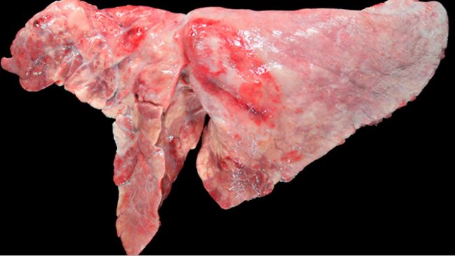 Figura 5: Pulm&oacute;n de un cerdo coinfectado con M. hyopneumoniae y A. pleuropneumoniae. &Aacute;reas de consolidaci&oacute;n craneoventrales de color marr&oacute;n-rojizo, provocada por la infecci&oacute;n por M. hyopneumoniae, y una lesi&oacute;n ovalada con fibrosis pleural y zonas hemorr&aacute;gicas en l&oacute;bulo diafragm&aacute;tico, que se corresponder&iacute;a a la cronicidad de un foco de necrosis producido por A. pleuropneumoniae.
