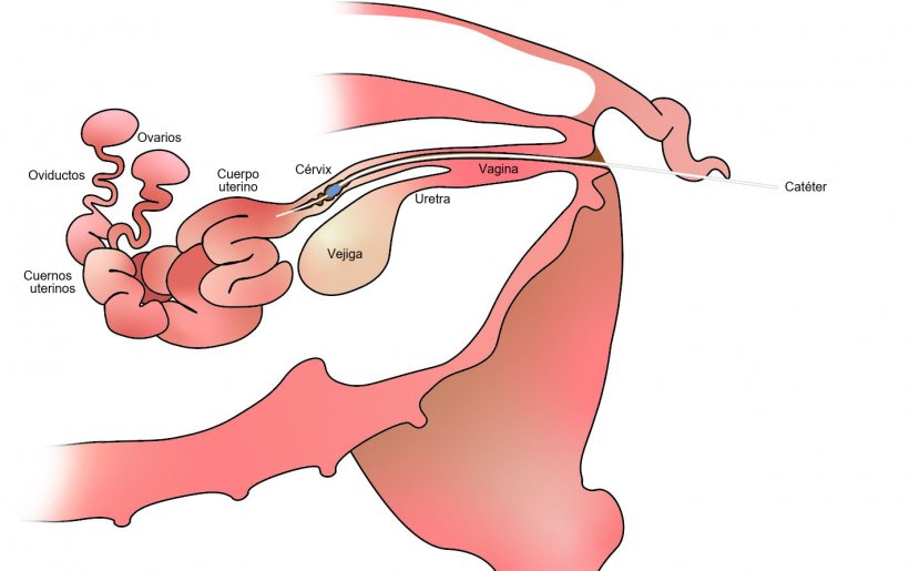 Imagen 1. En la inseminaci&oacute;n artificial postcervial el semen se deposita en el cuerpo del &uacute;tero, despu&eacute;s del c&eacute;rvix.
