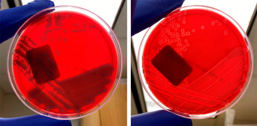 E. coli no hemol&iacute;tica (izquierda) y E. coli hemol&iacute;tica (derecha)
