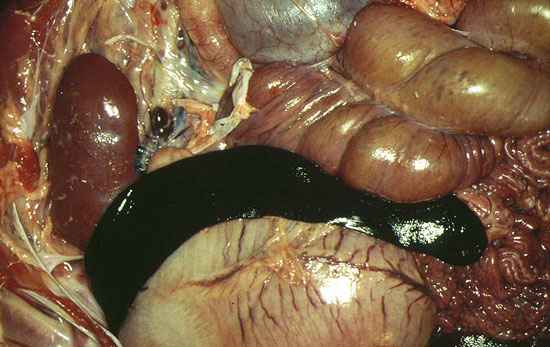 Hemorragias generalizadas, con ganglios infartados y esplenomegalia