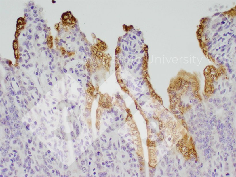 Figura 1. Tinci&oacute;n IHC de DEP en intestino delgado infectado. Fuente: Iowa State University VDL.
