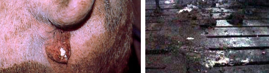 Descargas vaginales en cerdas