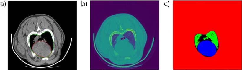Figura 6. Imágenes de TC donde se identifican el volumen y perfil cardíaco (a,b) y se diferencian los distintos tipos de tejido de forma automática (c).