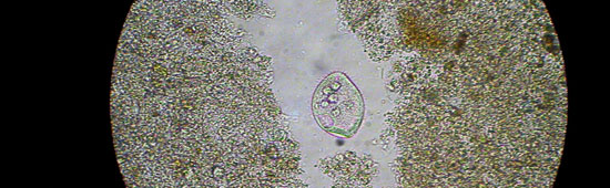 Trofozoíto de Balantidium coli