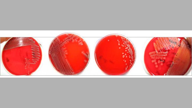 Différentes morphologies coloniales d’isolats d’E. coli pathogènes