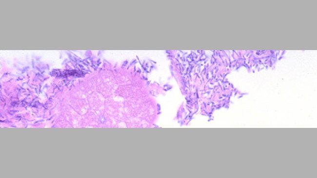 intestin grêle d’un porcelet avec de la diarrhée associée à l’infection par Clostridium perfringens de type A