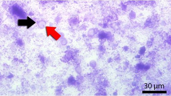 Frottis fécal coloré par Diff-Quick. La flèche rouge signale la vacuole centrale et la noire le noyau.