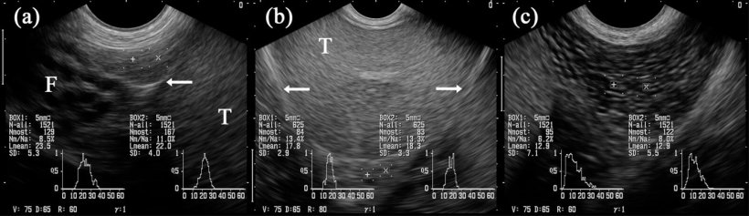 Figure 5: images &eacute;chographiques des segments &eacute;pididymaires: caput (= t&ecirc;te, a), corpus (b) et cauda (= queue; c). Les cases marqu&eacute;es &laquo; + &raquo; et &laquo; x &raquo; sont projet&eacute;es sur les segments respectifs de l'&eacute;pididyme. Testicule (T). Adjacente &agrave; la t&ecirc;te il y a plusieurs structures tubulaires identifi&eacute;es comme &eacute;tant des parties du funiculus spermaticus (F). Les fl&egrave;ches indiquent la couverture s&eacute;reuse du testicule (c'est &agrave; dire la bursa) testicularis. (Kauffold et al., 2011)
