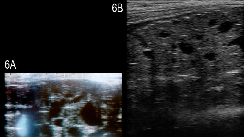 Figure&nbsp;6: Images de la glande bulbo-ur&eacute;trale d'un verrat atteint par de multiples kystes an&eacute;chog&eacute;niques &nbsp;bien d&eacute;finis de diff&eacute;rentes tailles (A) et d'un verrat sain (B) (Grahofer et al., 2016).
