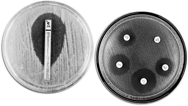 Techniques classiques d'évaluation de la résistance aux antibiotiques. A gauche on voit un E-TEST qui permet de mesurer la concentration minimum d'antibiotique qui empêche la croissance bactérienne. A droite on voit un antibiogramme où on observe différentes zones d'inhibition de la croissance dues aux antibiotiques.