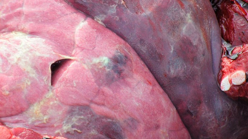 Lésion pulmonaire par App