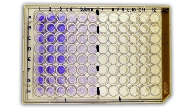 Figure 2b: Séroneutralisation(SN) pour la détection des anticorps contre le virus de la diarrhée virale bovine (BVDv) dans le sérum.