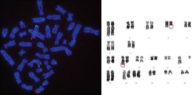 Des probl&egrave;mes de caryotype peuvent provoquer des baisses brutales&nbsp;de fertilit&eacute; et / ou de prolificit&eacute; lorsqu'on commence &agrave; utiliser ce m&acirc;le dans notre syst&egrave;me de production.
