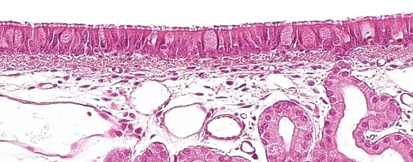 Figure 1: &Eacute;pith&eacute;lium pseudostratifi&eacute; cili&eacute; avec des cellules caliciformes caract&eacute;ristiques du syst&egrave;me respiratoire.
