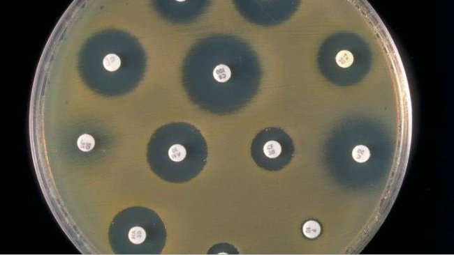 résistance antimicribienne