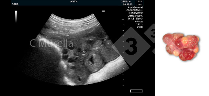 Figure 2. Follicules en ovulation.