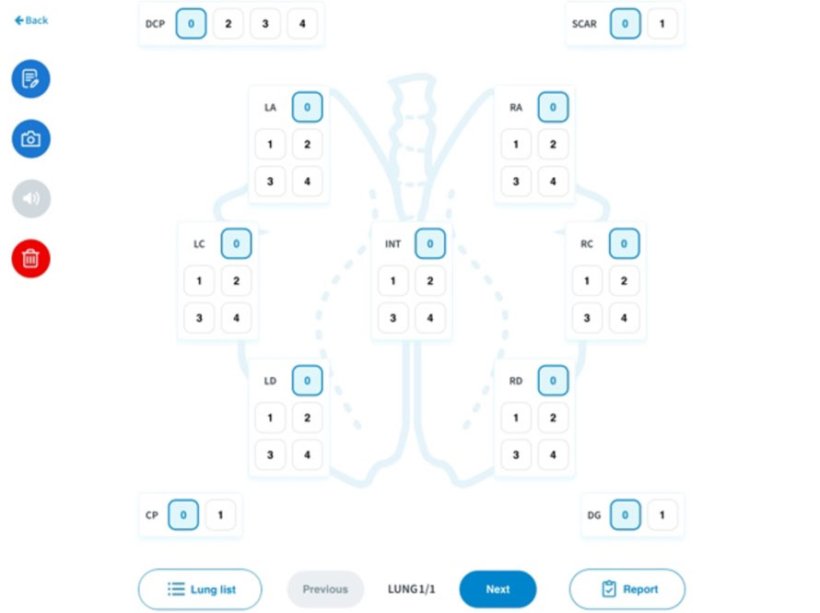 Figure 2 : Logiciel numérique utilisé pour l'évaluation. Les parties des poumons évaluées sur une échelle de points comprenaient le lobe apical gauche, le lobe cardiaque gauche, le lobe diaphragmatique gauche, le lobe moyen, le lobe diaphragmatique droit, le lobe cardiaque droit, le lobe apical droit, ainsi que les zones affectées par la pleurésie crâniale, la pleurésie dorso-caudale et la présence de cicatrices.