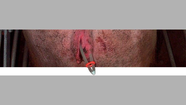 Cerrando los catéteres con gomas