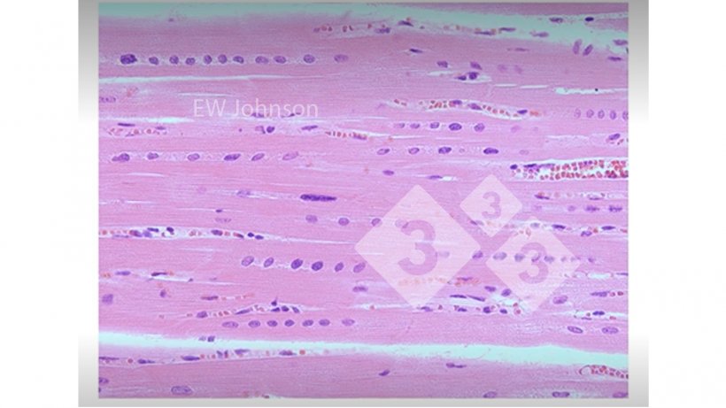 Figura 3. M&uacute;sculo card&iacute;aco con hemorragia, necrosis hialina y alineamiento de los n&uacute;cleos que muestra deficiencia de vitamina E y selenio. Estos cerdos no tendr&iacute;an un sistema inmunol&oacute;gico que funcionara normalmente.
