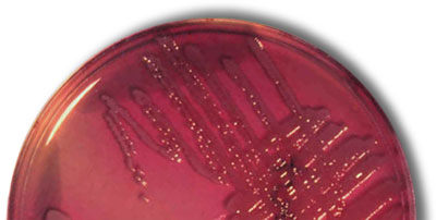 Cultivo de E. coli